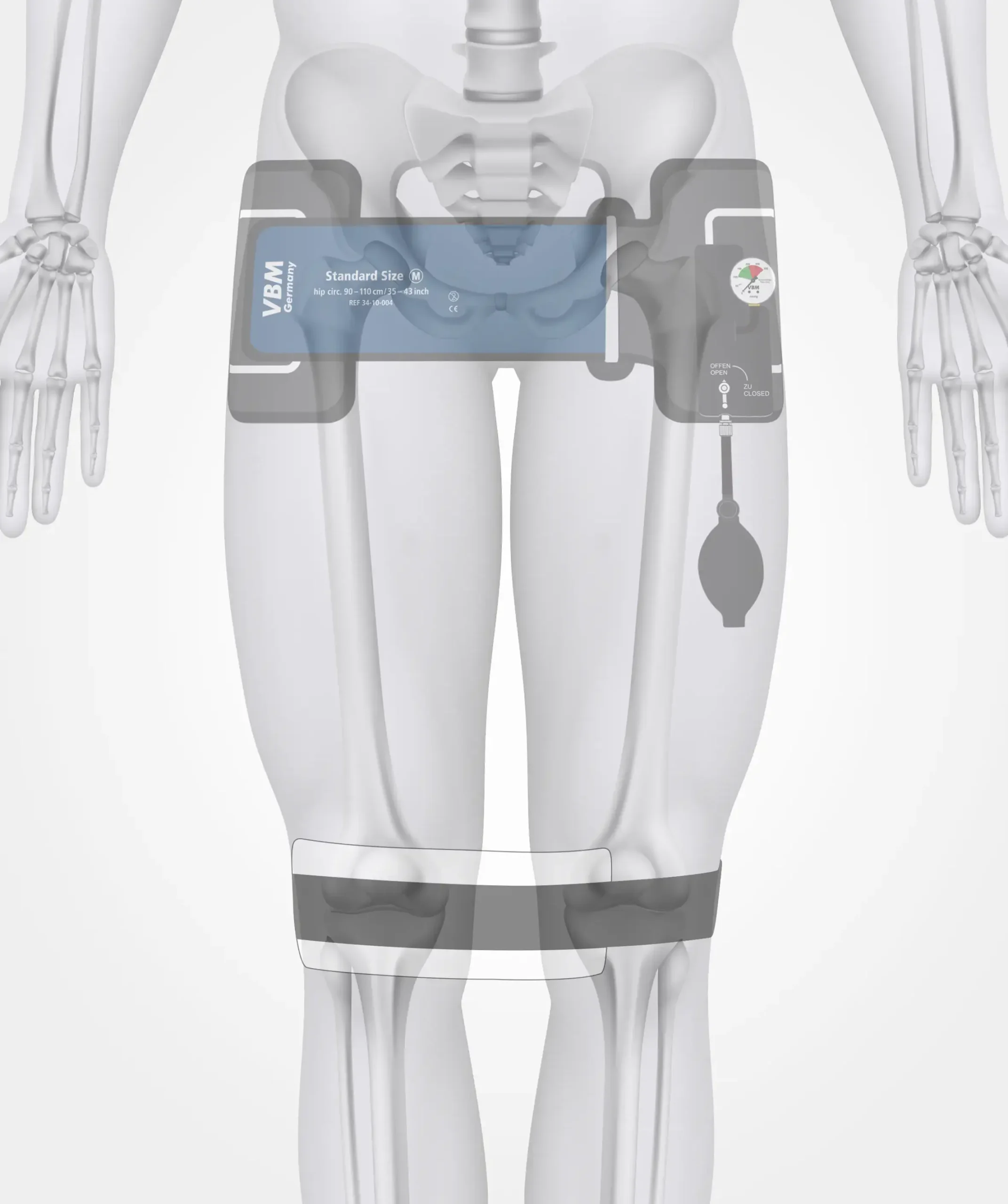 Pelvic Sling In Situ PIC00356 008 43OS AB scaled